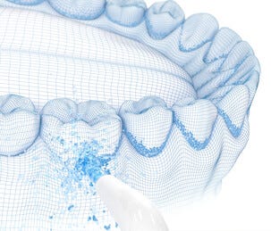 Mundusch Ekulf PowerFlosser