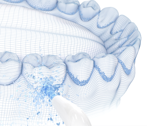 Mundusch Ekulf PowerFlosser