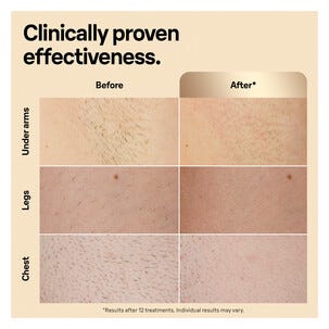 Braun Silk-Expert Pro 5 IPL hårborttagare, PL5052