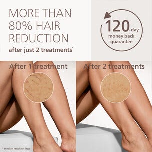 Philips Lumea IPL 9000 BRI983