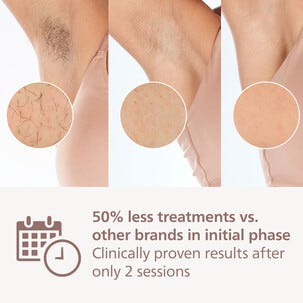 Philips Lumea 9000 IPL-karvanpoisto, Älykäs