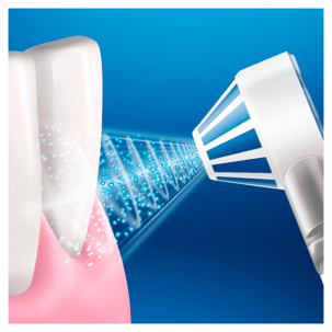 Mundusch Oral-B AquaCare 4 Water Flosser
