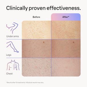 Braun Smart IPL Skin i expert hårborttagare PL7147